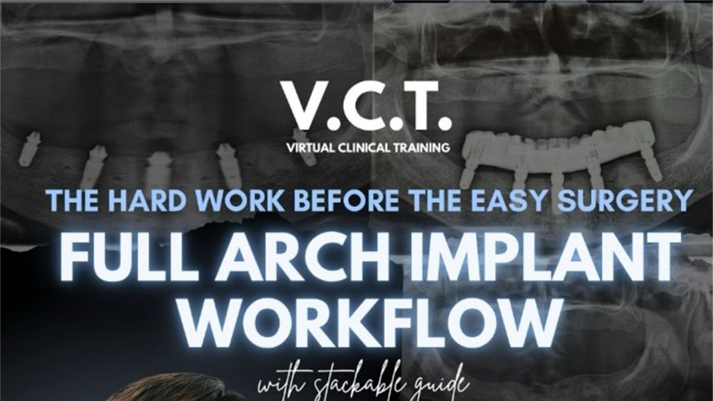 Full Arch Implant Workflow: The Hard Work Before the Easy Surgery